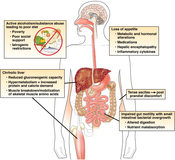 piis1542356511011694_gr1_lrg