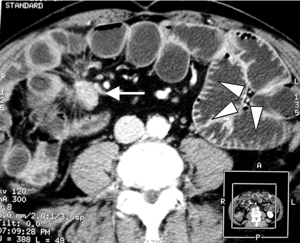 pmc1458416_ci04014506